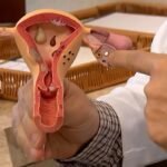 Edital do CNPq vai financiar pesquisas sobre endometriose