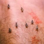 Febre do Nilo: sinais de alerta para casos graves