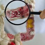 Ultraprocessados entram no alerta sobre doenças intestinais